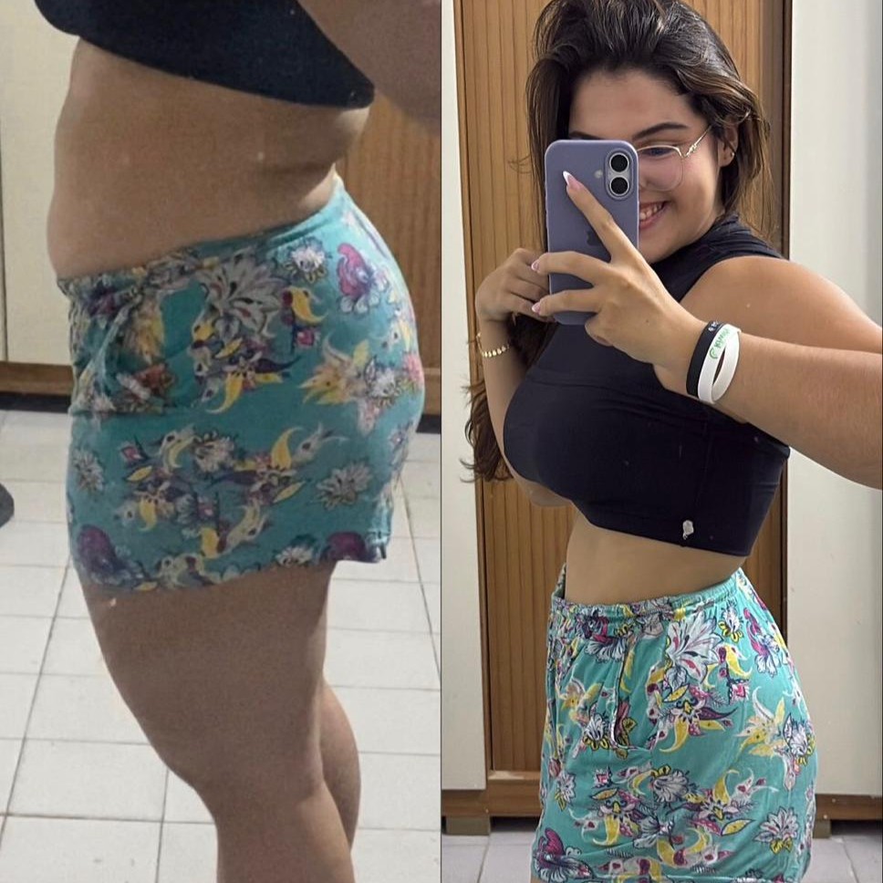 Transformação real — antes e depois